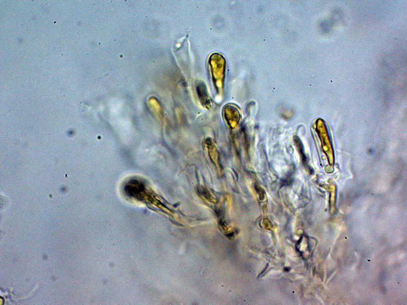 Una corticale granulare da identificare